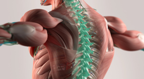 Sitka thoracic spine