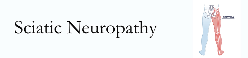 Sitka neuropathy pain (sciatica) 
